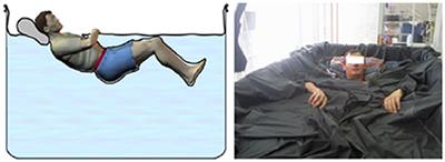Impacts of Simulated Weightlessness by Dry Immersion on Optic Nerve Sheath Diameter and Cerebral Autoregulation